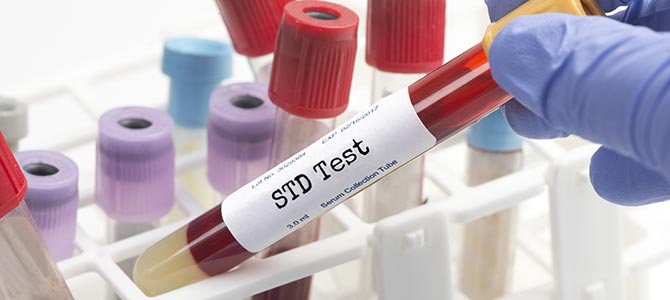 Confidential STD Testing Clinic Near Me in Brooklyn and East Harlem, NYC Confidential STD Testing Clinic Near Me in Brooklyn and East Harlem, NYC