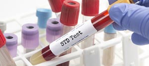 Confidential STD Testing Clinic Near Me in Brooklyn and East Harlem, NYC Confidential STD Testing Clinic Near Me in Brooklyn and East Harlem, NYC