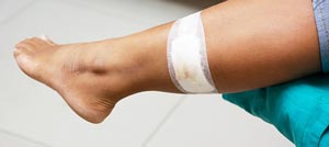 Stitches and Lacerations Specialist Near Me in Brooklyn NYC and East Harlem, NYC Stitches and Lacerations Specialist Near Me in Brooklyn NYC and East Harlem, NYC