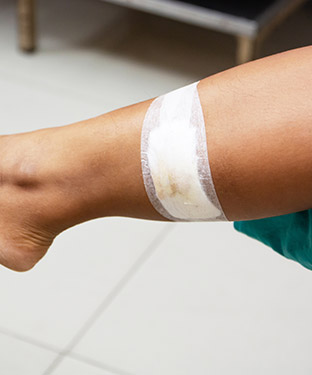 Stitches Treatment Near Me in Brooklyn NYC, and East Harlem NYC 