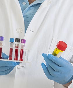 Urine Testing Near Me in Brooklyn NYC, and East Harlem NYC 