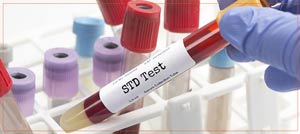 Confidential STD Testing Clinic Near Me in East Harlem, Metropolitan and Staten Island NYC