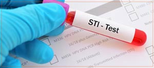 Confidential STI Testing Clinic Near Me in East Harlem, Metropolitan and Staten Island NYC